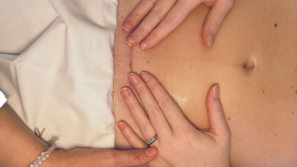 masaje-cicatriz-cesarea